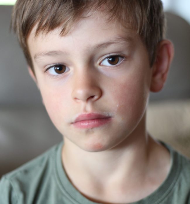 Image of a young boy looking sadly at camera.